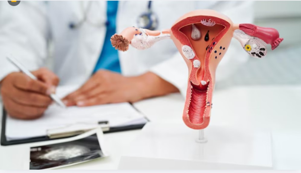 Best Fibroid Treatment Doctor in Kolshet Road, Thane