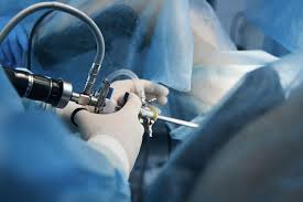 Hysteroscopic Surgery